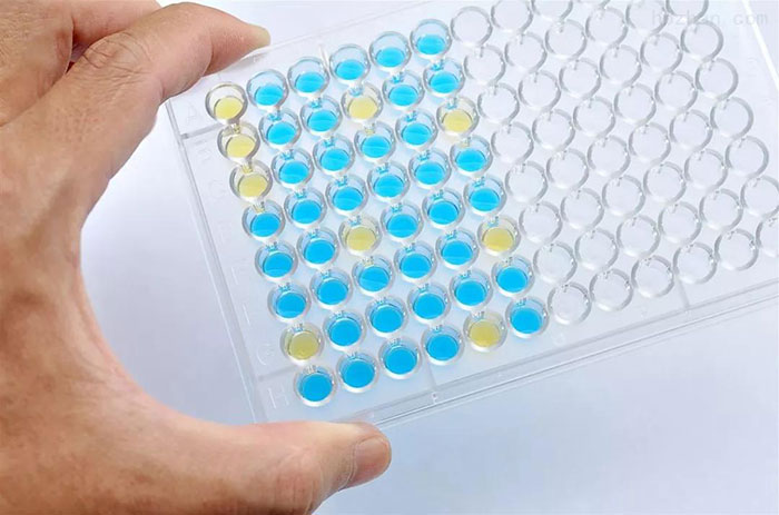 新冠病毒PCR实验室检测